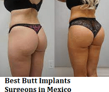 Instructions to Grow a Bigger Butt If You’re Flat